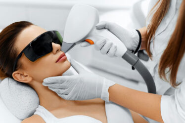 Depilação a laser facial