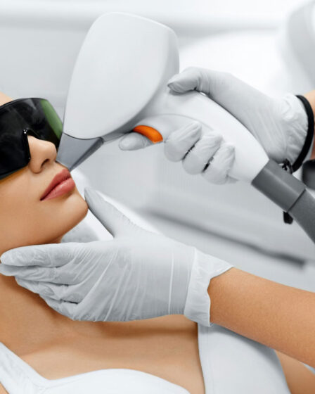 Depilação a laser facial