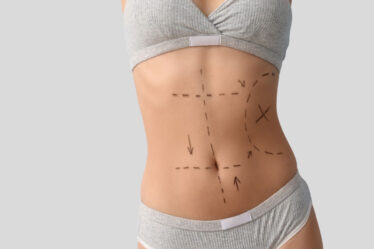 Lipo sem cortes na Zahra
