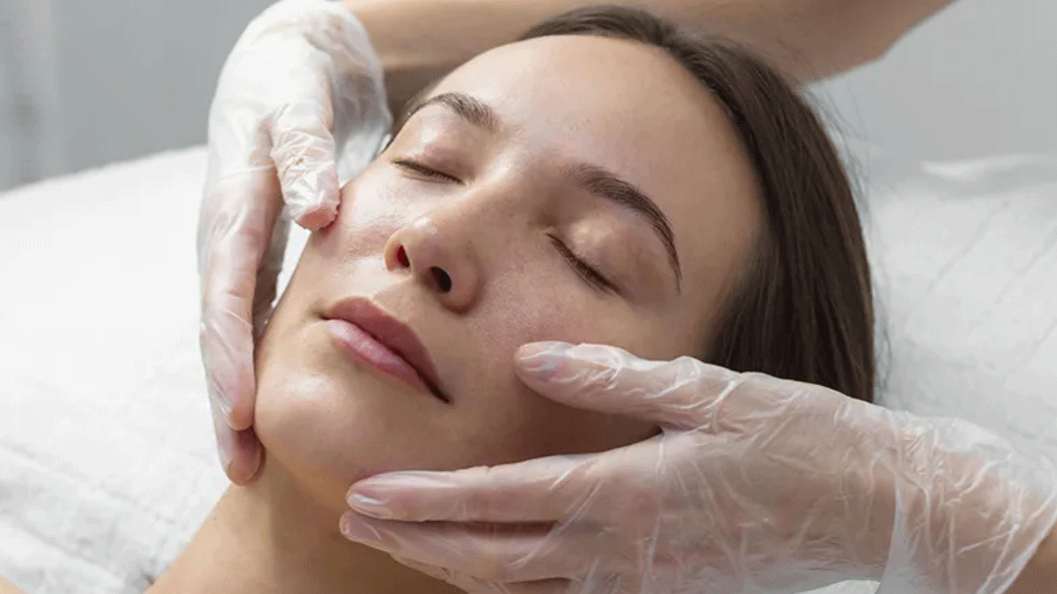 Saiba como peeling superficial clareia manchas e uniformiza pele
