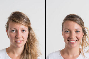 Laser lavieen na Zahra