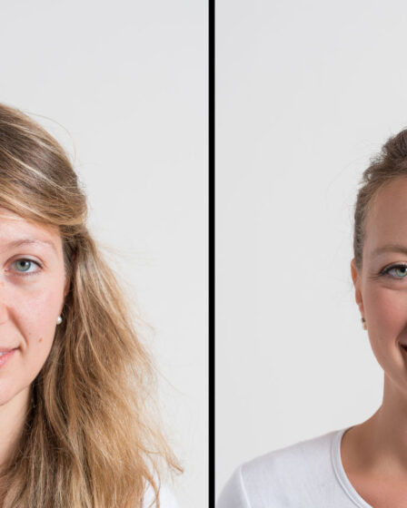 Laser lavieen na Zahra