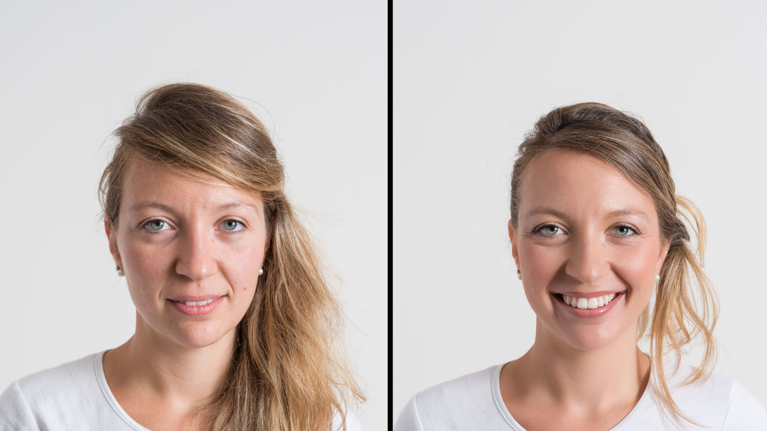 Laser lavieen na Zahra