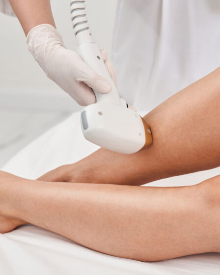 Depilação a laser: o guia completo para uma pele lisa, macia e livre de pelos com segurança e resultados duradouros