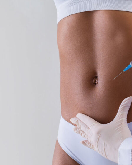 Intradermoterapia: tratamento estético avançado que reduz celulite e melhora a firmeza da pele