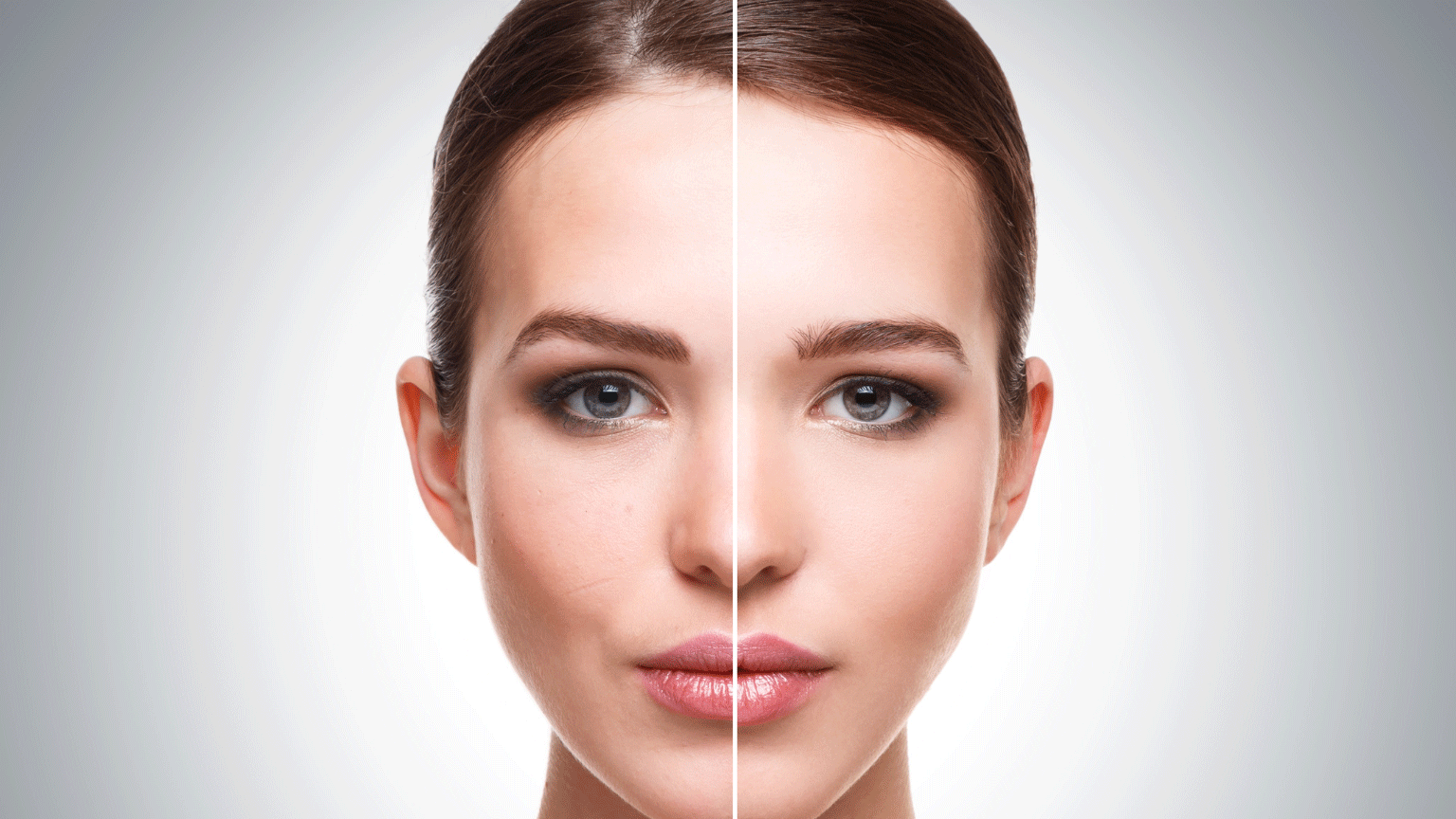 Laser Lavieen: para que serve, resultados, antes e depois e quando vale a pena