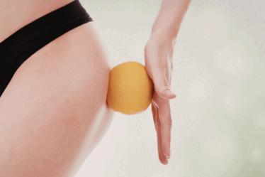 Celulite: 10 dicas infalíveis para reduzir o aspecto de “casca de laranja”