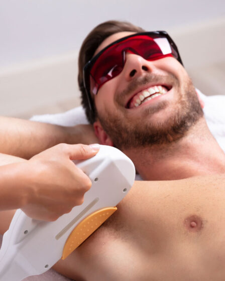 Depilação a laser: tudo o que você precisa saber antes de começar