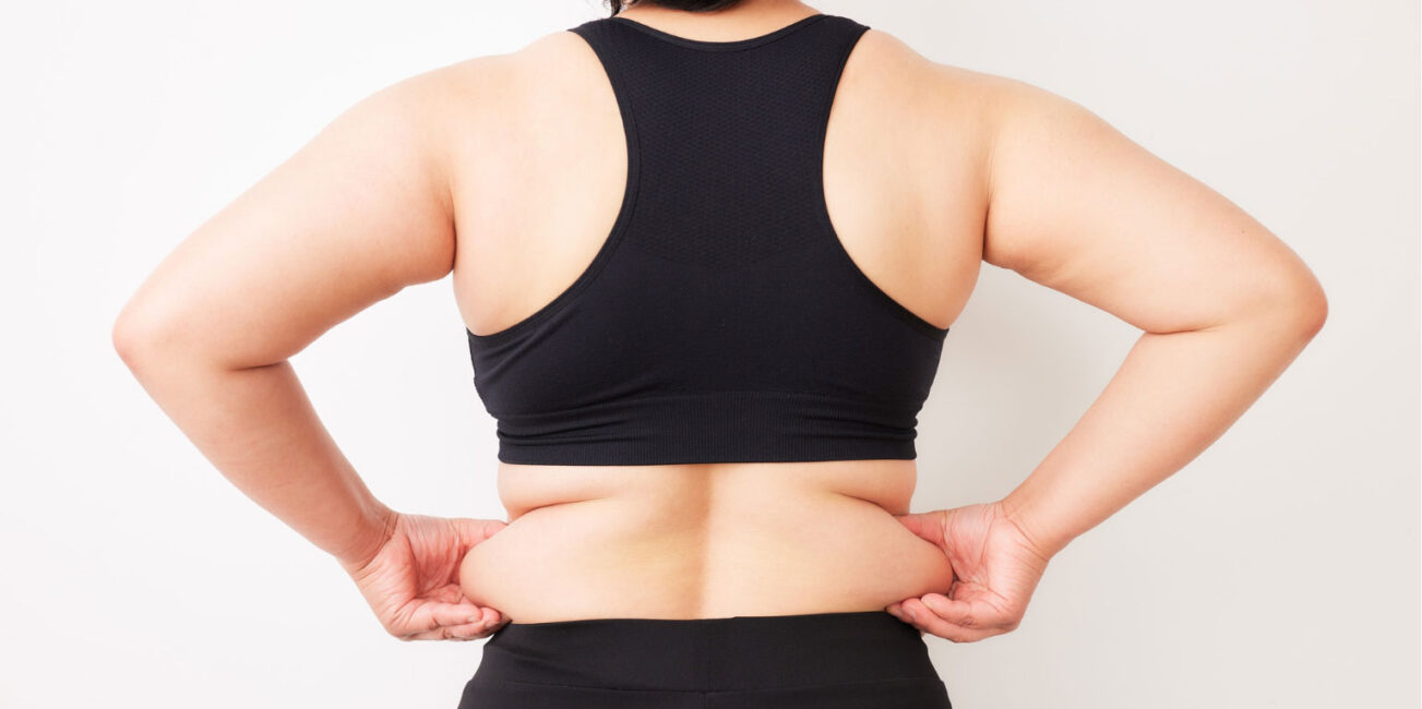 Retenção de líquidos: por que o corpo fica inchado?
