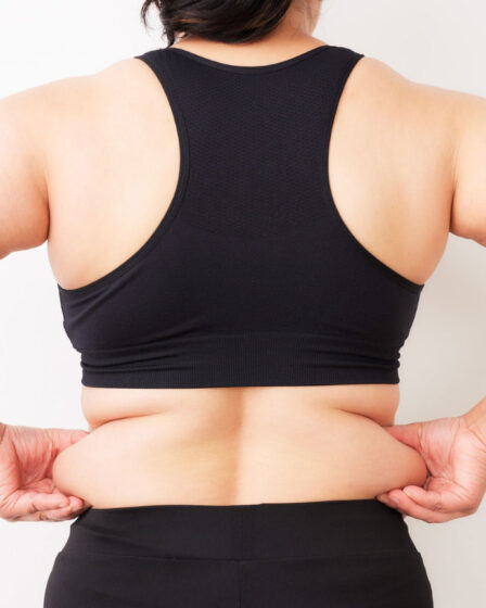 Retenção de líquidos: por que o corpo fica inchado?