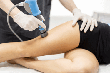 Shock wave para celulite: conheça os benefícios da terapia por ondas de choque