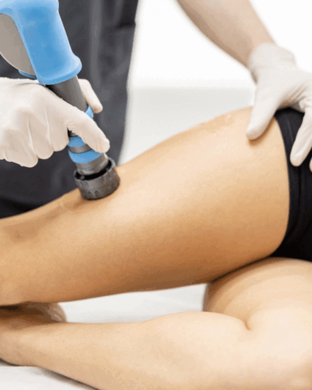 Shock wave para celulite: conheça os benefícios da terapia por ondas de choque