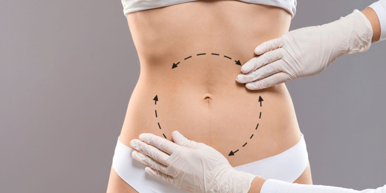 Tratamentos estéticos para o verão: ainda dá tempo de preparar o corpo e cuidar de você